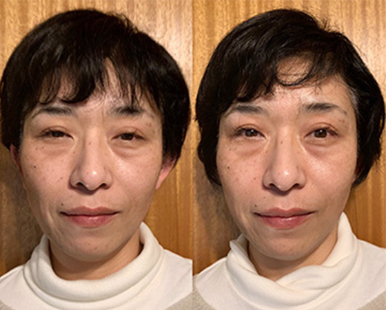 体験でご来店 40代女性