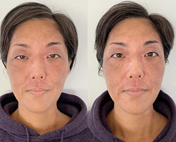 体験でご来店 40代女性