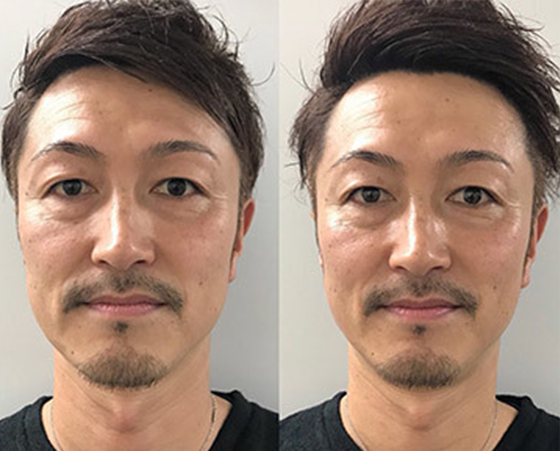 体験でご来店 40代女性